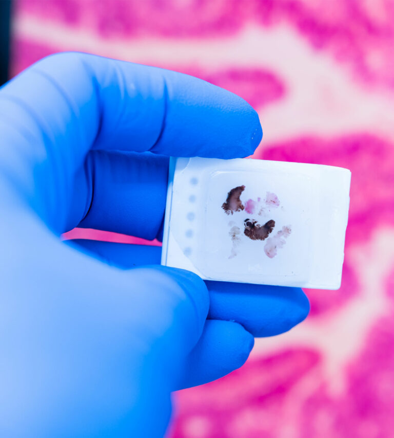 Small Tissue Sample High-Quality Tissue Specimens for Research | Boca Biolistics