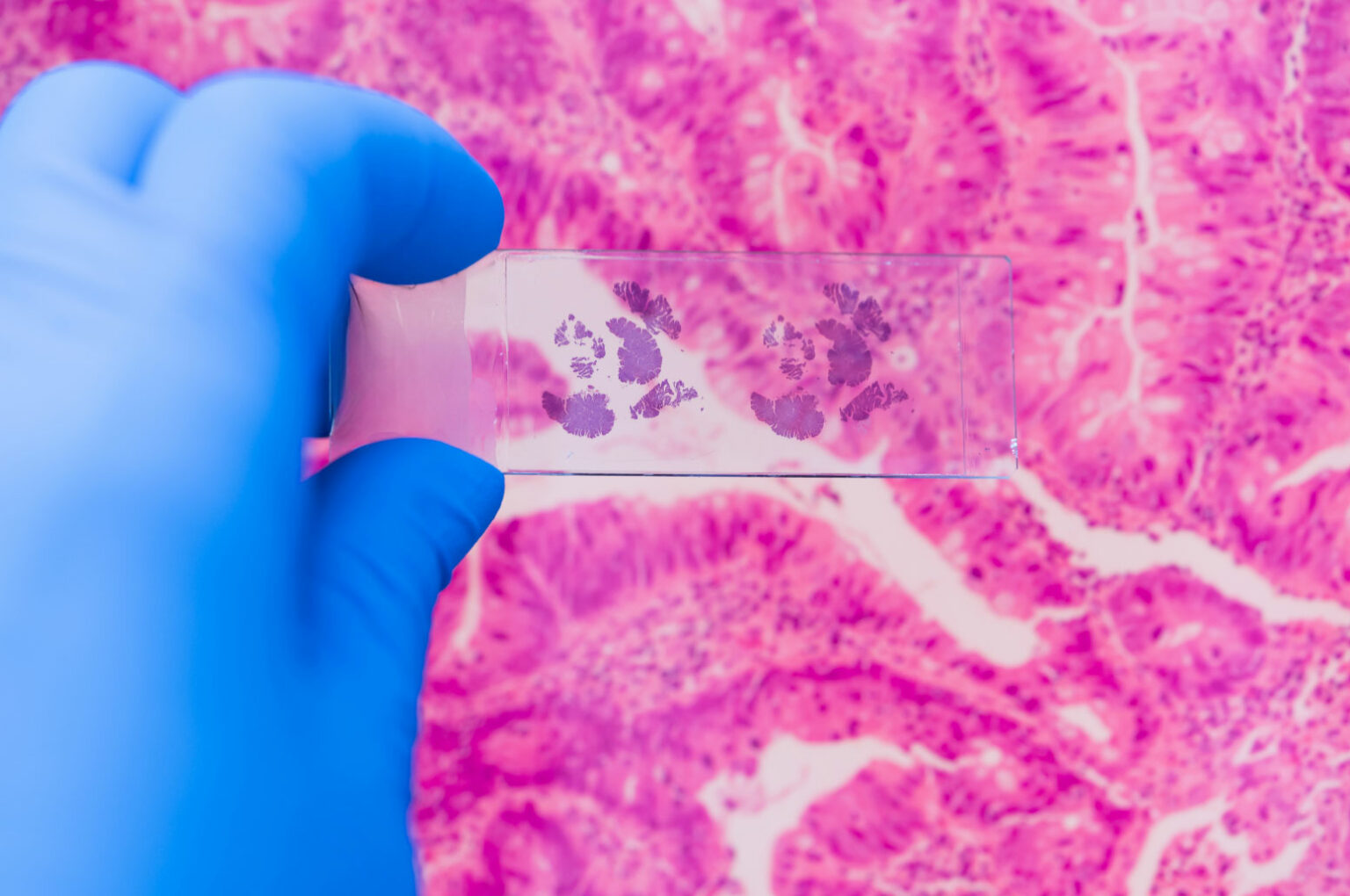 Biospecimens for Research | Boca Biolistics